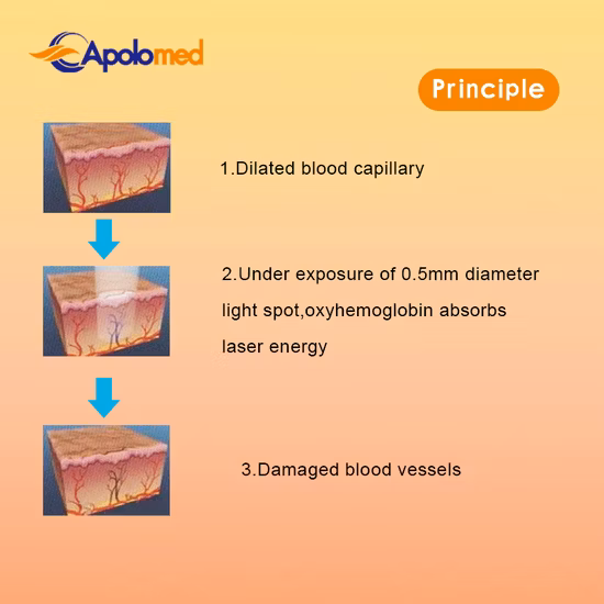 Equipamento para beleza da pele Mini safira Ice Cool Laser IPL dispositivo para depilação